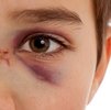 Perspektivenwechsel: Stell dir vor, du bist ein Opfer von Gewalt