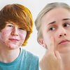 Die Phasen der Pubertät und „typisches“ Teenager-Verhalten